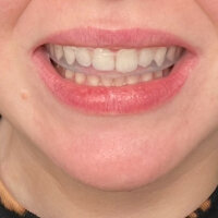 Array image