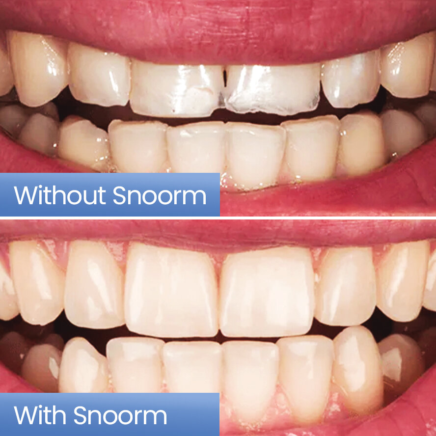 Snoorm image